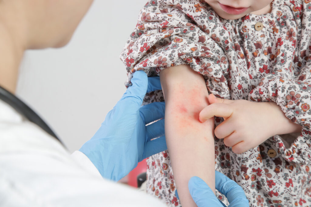 allergy and immunology image